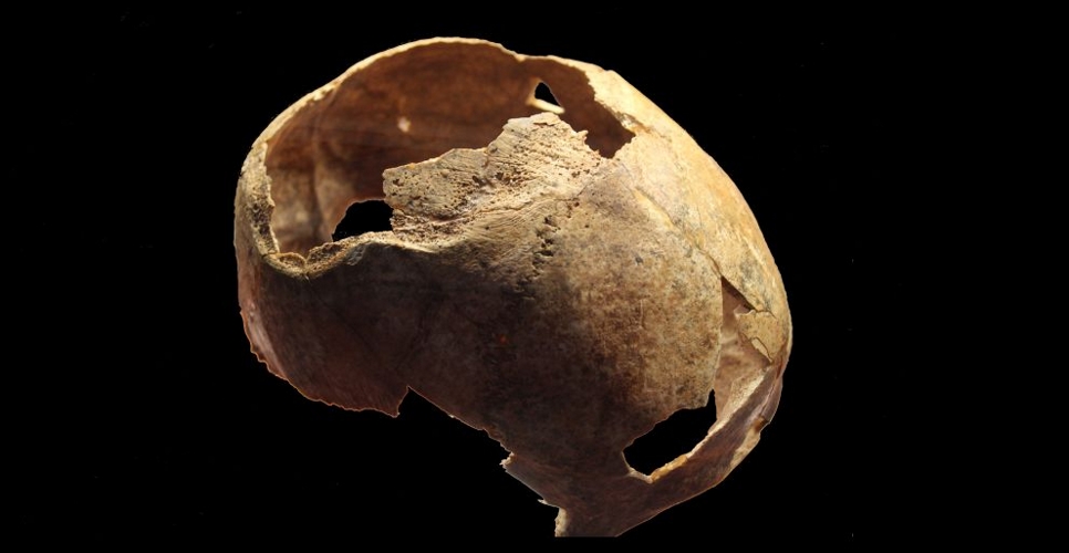 В Крыму найден череп со следами обширной трепанации эпохи бронзы